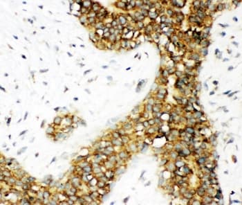 CALB1 / Calbindin Antibody (aa2-175)