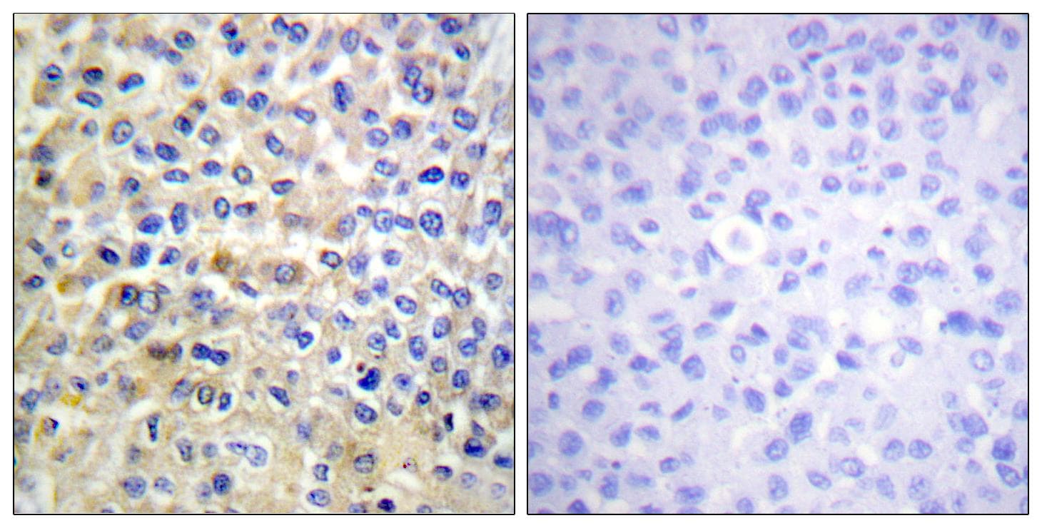 EGFR Antibody (p678)