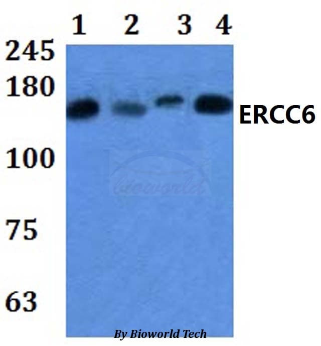 ERCC6 / CSB Antibody