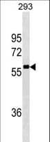 Monoclonal Mouse anti-Human ARA70 / NCOA4 Antibody (WB)