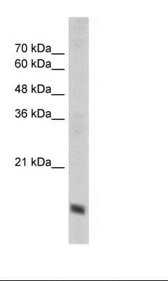 Polyclonal Rabbit anti-Human COXIV / COX4 Antibody (N-Terminus, IHC, WB)