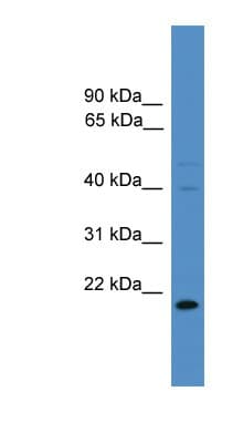 TIMP3 Antibody (N-Terminus)