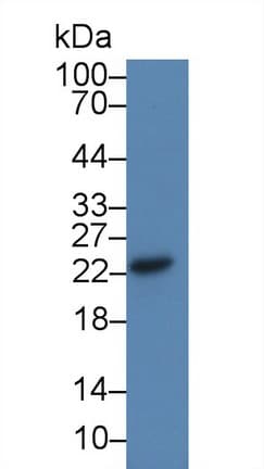 CDO1 / Cysteine Dioxygenase Antibody (aa1-200, Biotin)