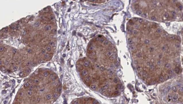 NCR1 / NKP46 Antibody