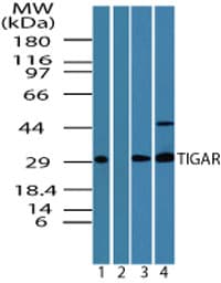 IHC-plus™ TIGAR Antibody (aa140-190)