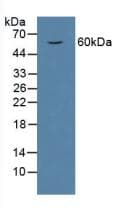 HPSE / Heparanase Antibody (aa40-188)