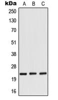 Polyclonal Rabbit anti-Human RANBP1 Antibody (Internal, WB)