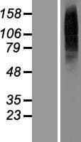 TMEM56 Protein (Over-Expression Lysate Myc-DDK (Flag))