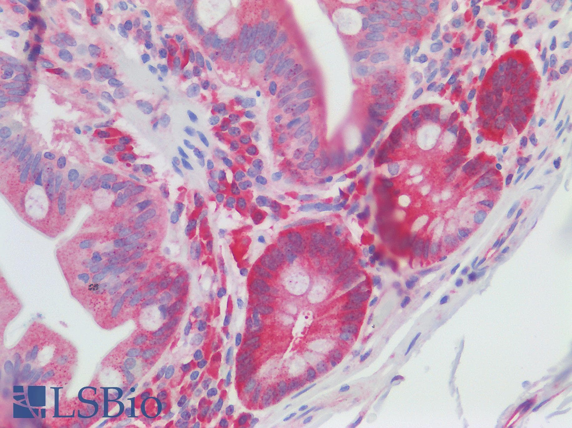 IHC-plus™ RANBP1 Antibody (aa1-50)