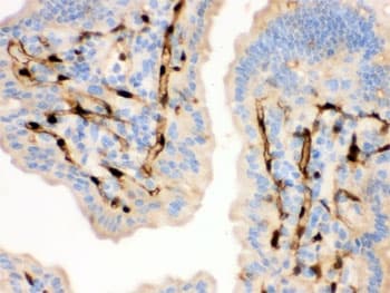 Polyclonal Rabbit anti-Human FABP4 / AP2 Antibody (IHC, WB)