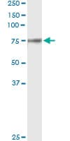 F2 / Prothrombin / Thrombin Antibody (clone 1B7)