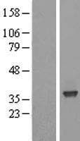 SFXN3 / Sideroflexin 3 Protein (Over-Expression Lysate Myc-DDK (Flag))