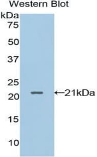 Polyclonal Rabbit anti-Rat LECT2 Antibody (Biotin, aa1-151, WB)