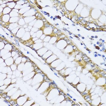 ALOX12 / 12 Lipoxygenase Antibody