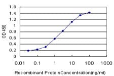 IHC-plus™ SMURF1 Antibody (clone 1D7)