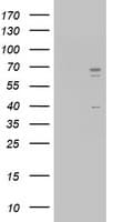 Monoclonal Mouse anti-Human CD5 Antibody (clone OTI4F9, WB)
