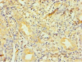 Polyclonal Rabbit anti-Human DCTN1 / Dynactin 1 Antibody (aa1084-1278, IHC, WB)