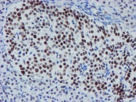 METTL16 / METT10D Antibody (clone OTI3B5)