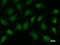 Monoclonal Mouse anti-Human SMAD1 Antibody (clone 913C1b, IF, WB)