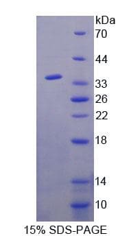 Rat AGXT2 Protein (Recombinant His-T7, N-terminus)