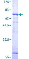 Human MVD Protein (Recombinant GST)