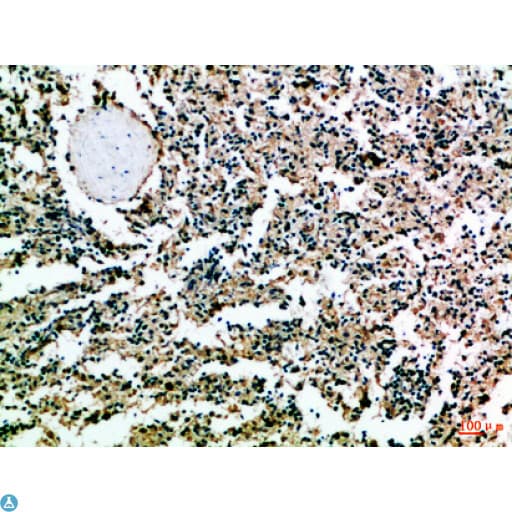 Polyclonal Rabbit anti-Human CD52 Antibody (WB)