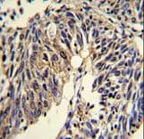 Polyclonal Rabbit anti-Human TNFRSF14 / CD270 / HVEM Antibody (aa210-236, IHC, WB)