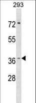 HT036 / HYI Antibody (aa47-73)