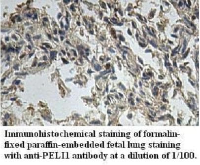 PELI1 / Pellino 1 Antibody (aa145-404)