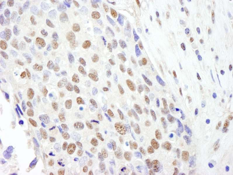 SF3B2 Antibody (aa775-825)