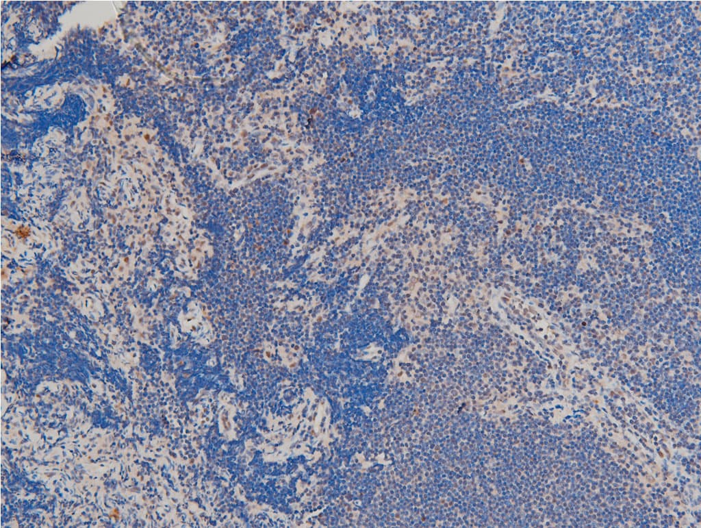 LIMK1 / LIMK Antibody (phospho-Thr508)