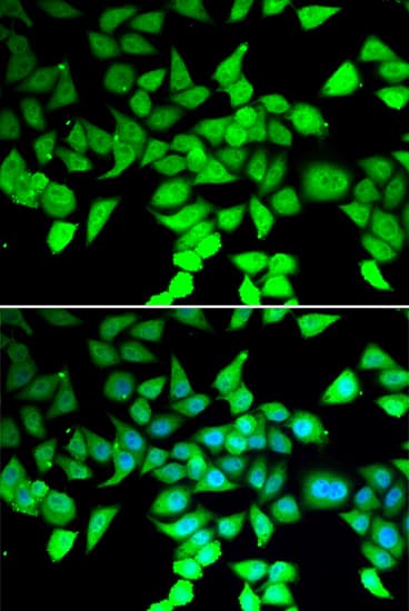 HDAC7 Antibody