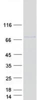 Human APC6 / CDC16 Protein (Recombinant Myc-DDK (Flag))