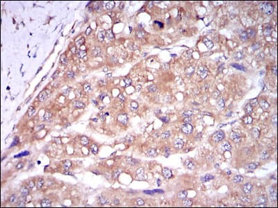 Monoclonal Mouse anti-Human CASP8 / Caspase 8 Antibody (clone 1H11, IHC, WB)