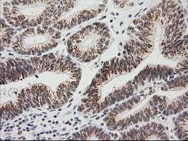 LOX / Lysyl Oxidase Antibody (clone OTI10D11)