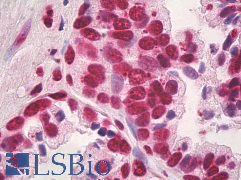 IHC-plus™ HMG1 / HMGB1 Antibody (clone IMG19N10B7)