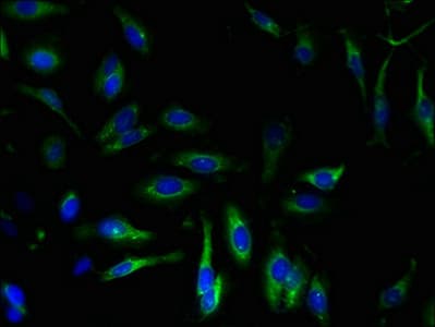 ATP2A2 / SERCA2 Antibody