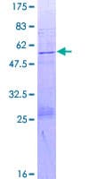 Human DUSP15 Protein (Recombinant GST)