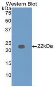 Adiponectin Antibody (aa19-244)