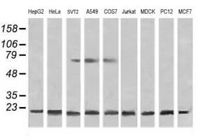 NDUFB10 Antibody (clone OTI4F1)