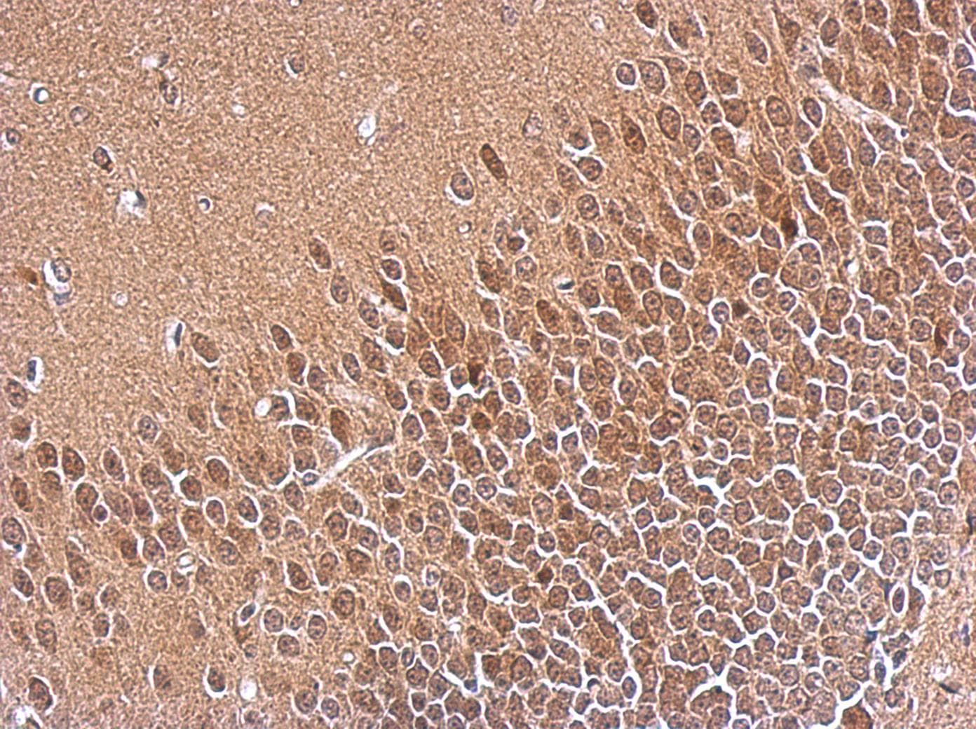 SKP1 Antibody