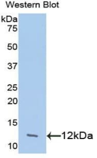 CCL24 / Eotaxin 2 Antibody (aa27-119)
