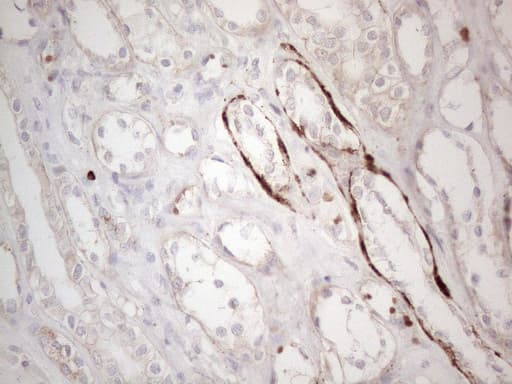Monoclonal Mouse anti-Human CLU / Clusterin Antibody (clone OTI5D3, aa23-227, IHC, WB)