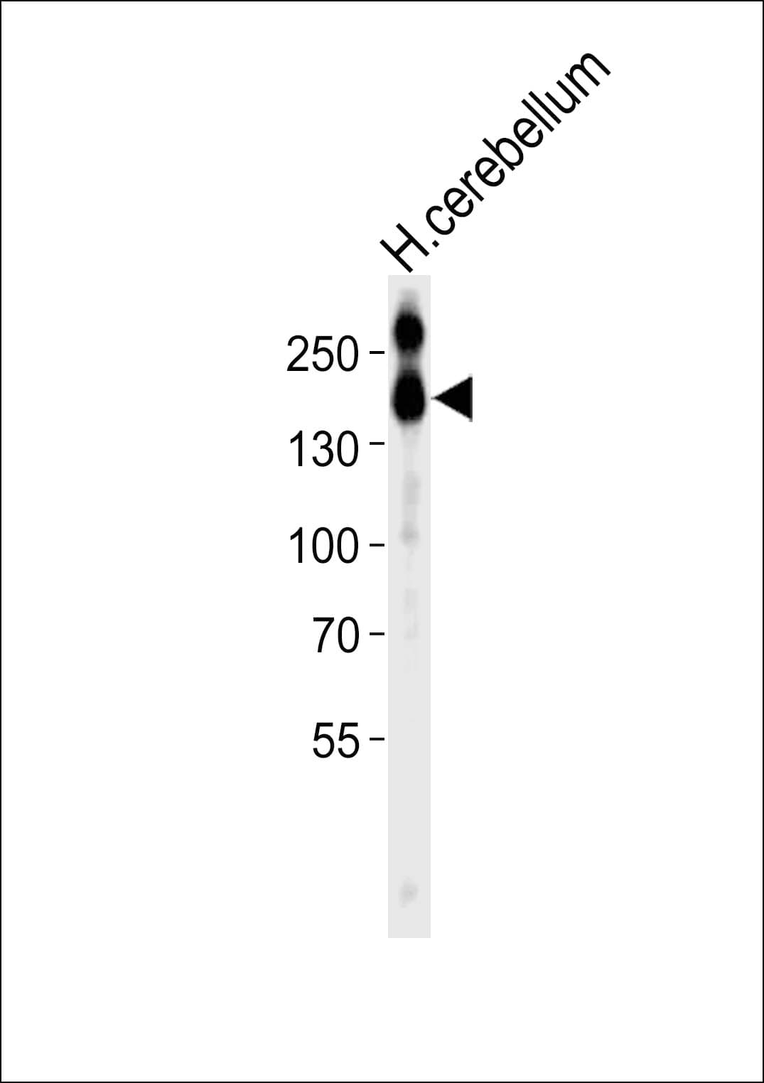 NCAM / CD56 Antibody (aa829-863)