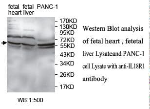 IHC-plus™ CDw218a / IL18R1 Antibody (aa32-329)
