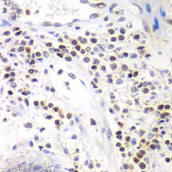SMARCA4 / BRG1 Antibody