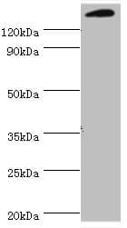 Polyclonal Rabbit anti-Human SMARCC2 Antibody (aa300-650, IHC, WB)