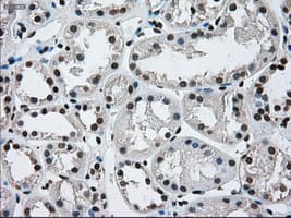 ERCC1 Antibody (clone OTI1A3)