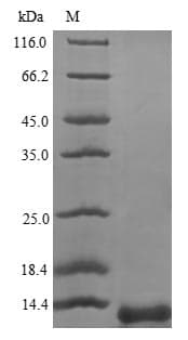 Human PSAP / Prosaposin Protein (Recombinant 6His, N-terminus)