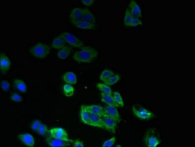 SPTLC2 / LCB2 Antibody (aa88-562)